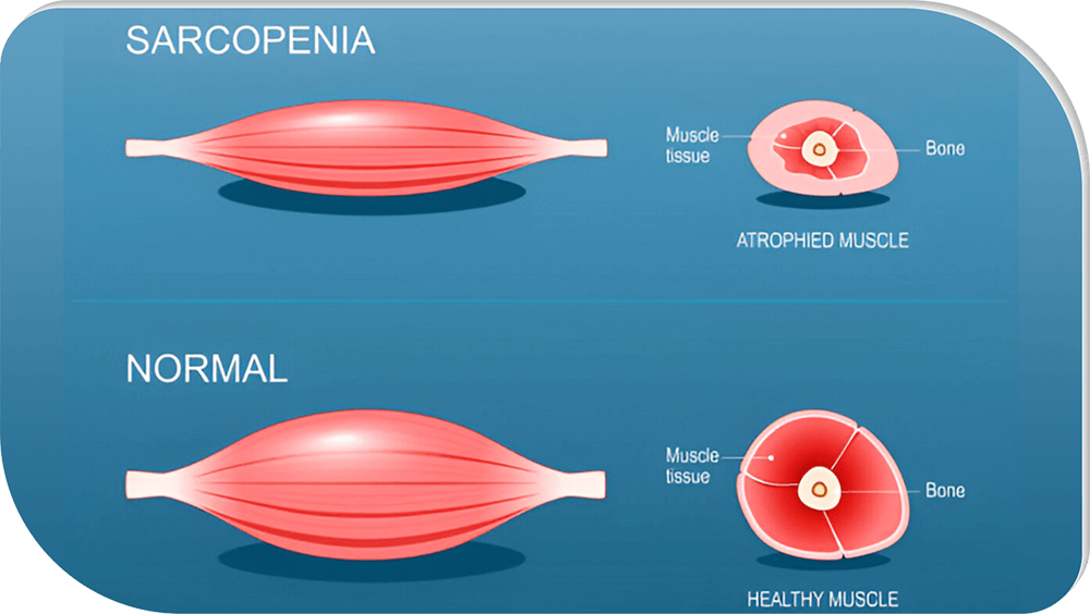 Therapy of Urinary Tract Health